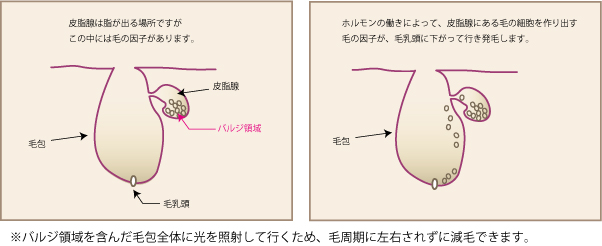 長野市セルフ脱毛ラピスアシュレイ